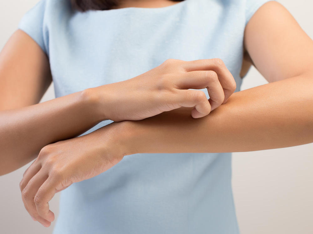 Serba Serbi Keratosis Pilaris Kondisi Permukaan Kulit Dengan Bintik Kecil Mirip Jerawat Beauty Journal